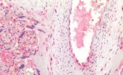 Immunohistochemistry-Paraffin: VEGF 165 Antibody [NBP3-14567]